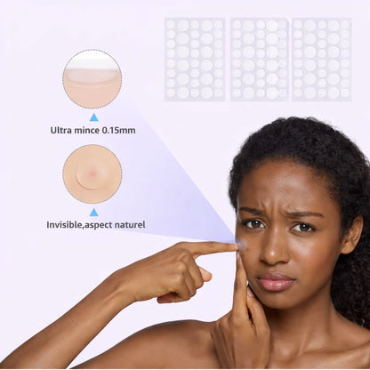 Patch anti-acné invisible – Élimine les boutons en une nuit