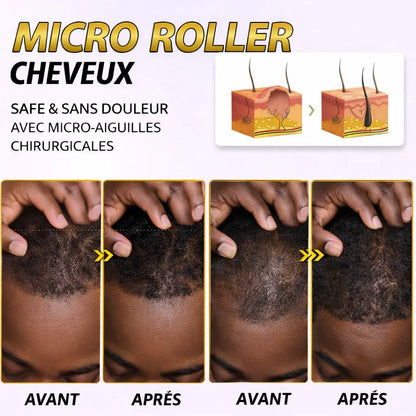 Derma Roller visage – Peau lisse, anti-acné et éclat naturel